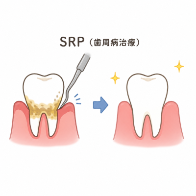 SRPって何をするの?