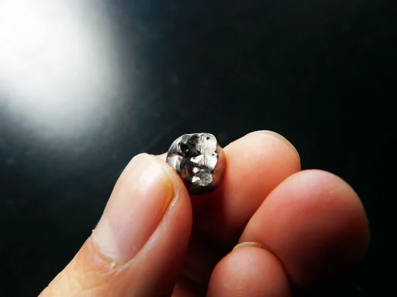 詰め物・被せ物が取れた